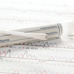 Where are large cotton swabs used