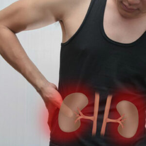 Kidney Failure – Causes and Symptoms
